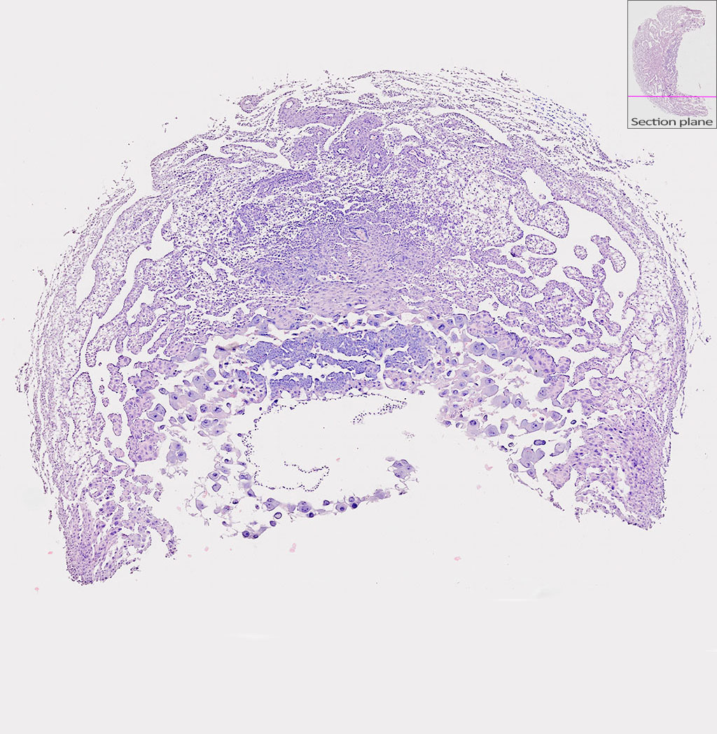 e9.5 mouse placenta