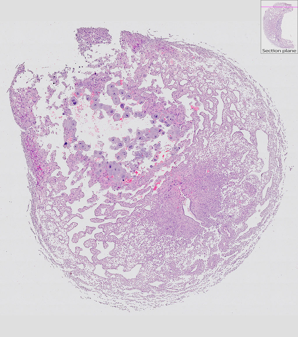 e9.5 mouse placenta