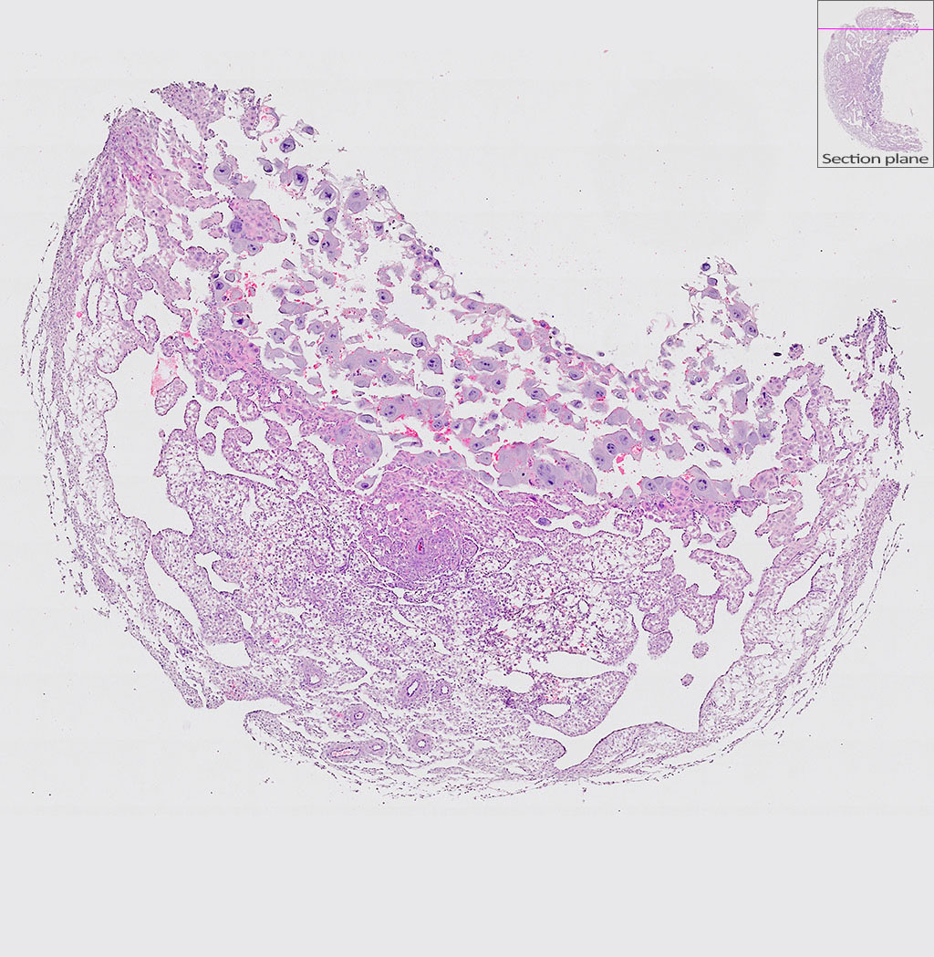 e9.5 mouse placenta