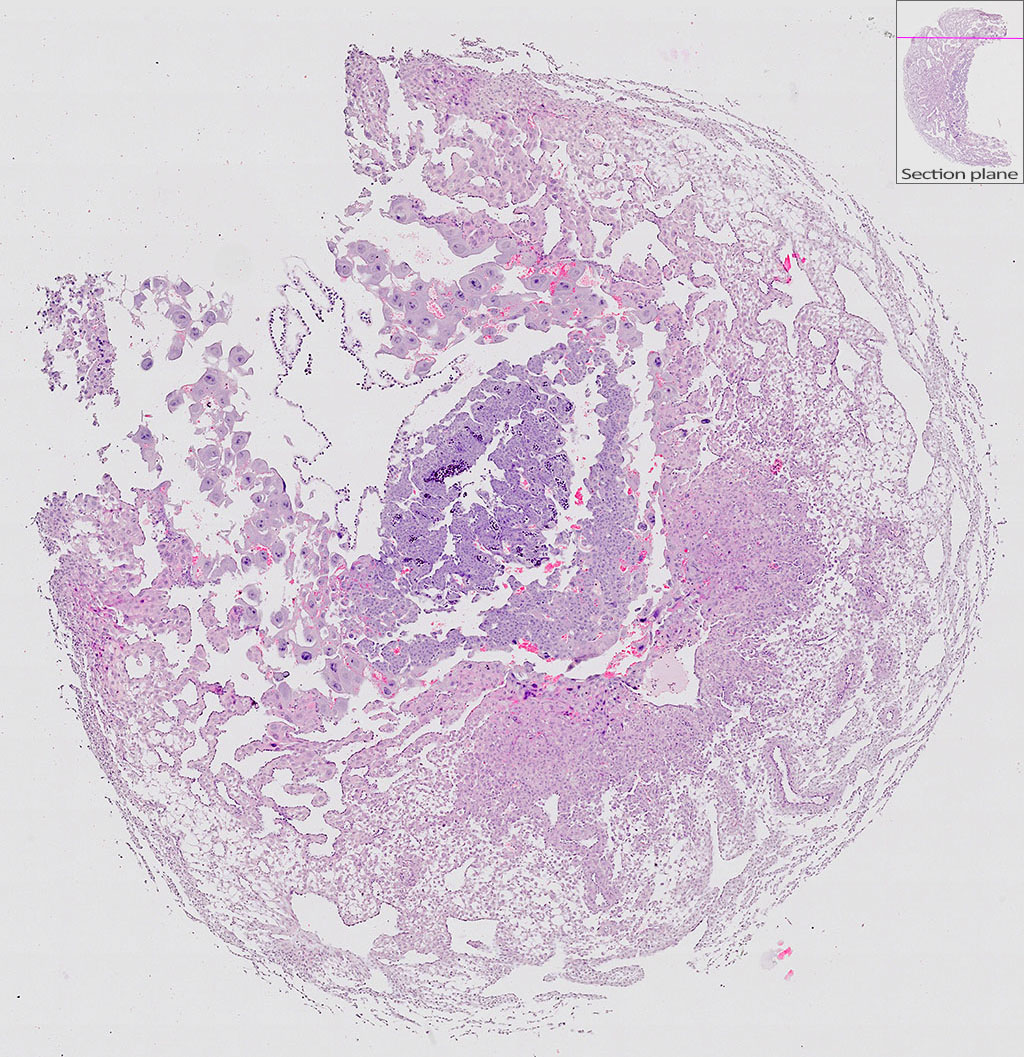 e9.5 mouse placenta
