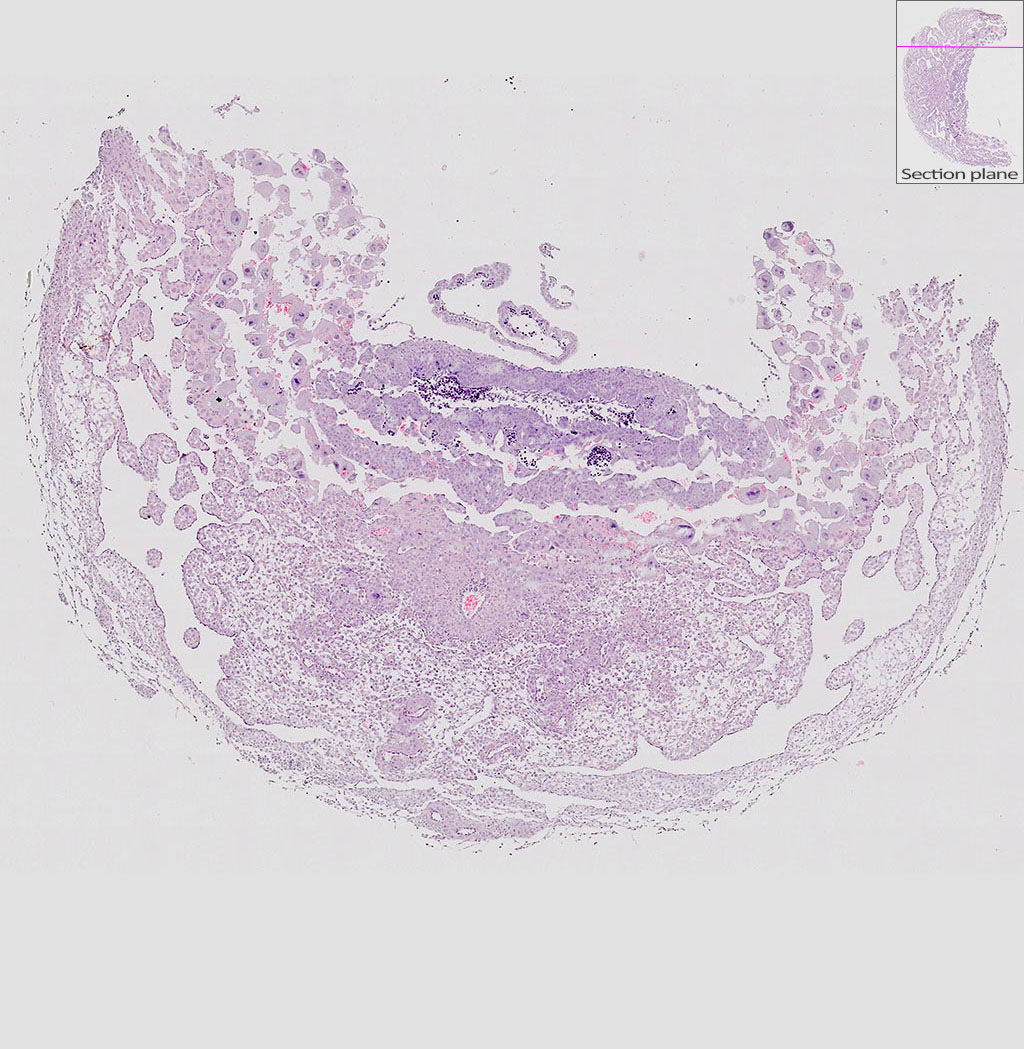 e9.5 mouse placenta