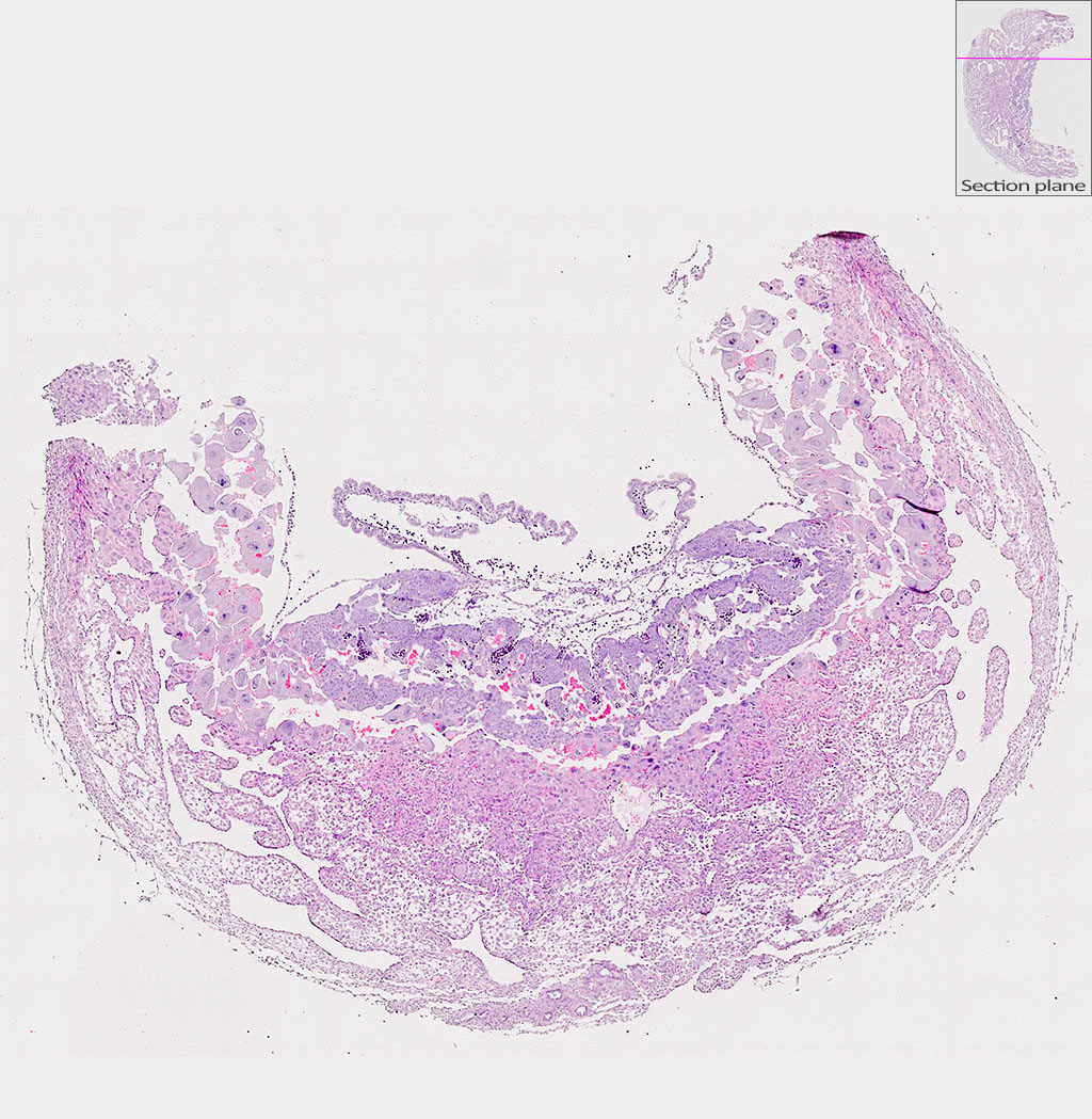 e9.5 mouse placenta