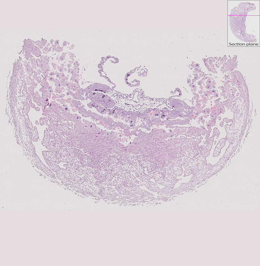 e9.5 mouse placenta