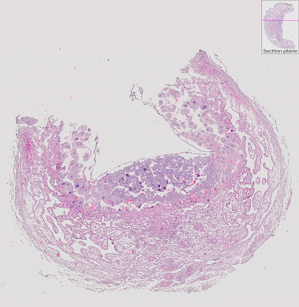 e9.5 mouse placenta