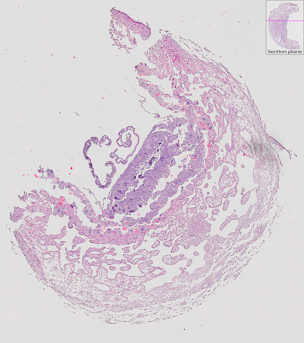 e9.5 mouse placenta