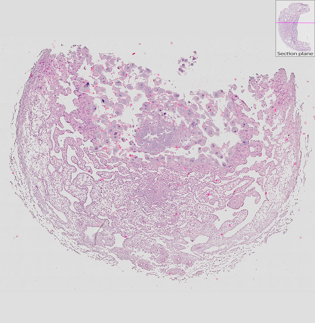 e9.5 mouse placenta