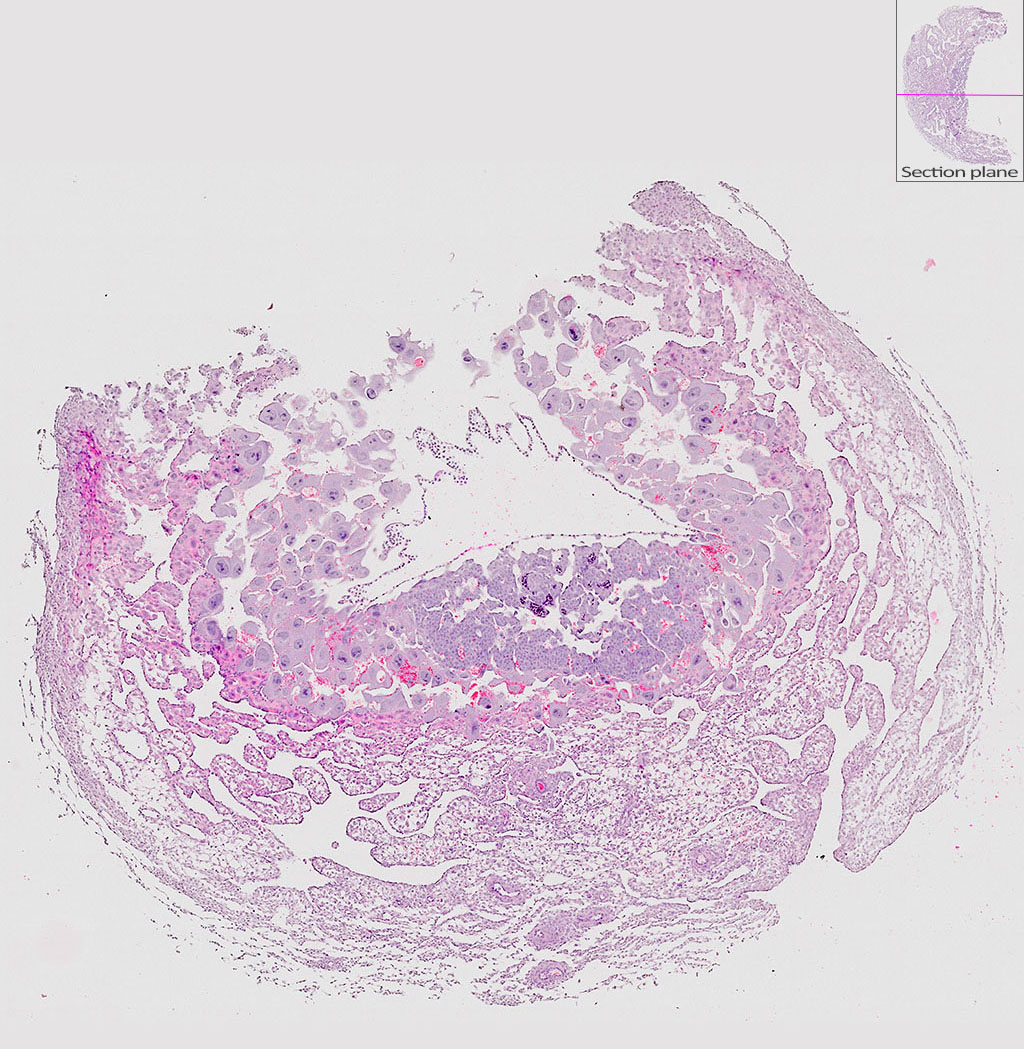e9.5 mouse placenta