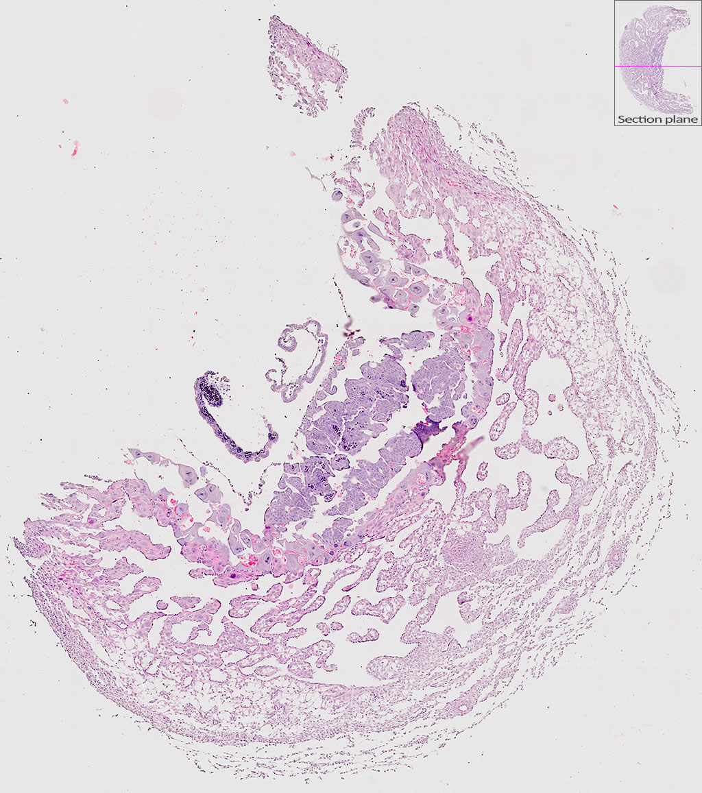 e9.5 mouse placenta