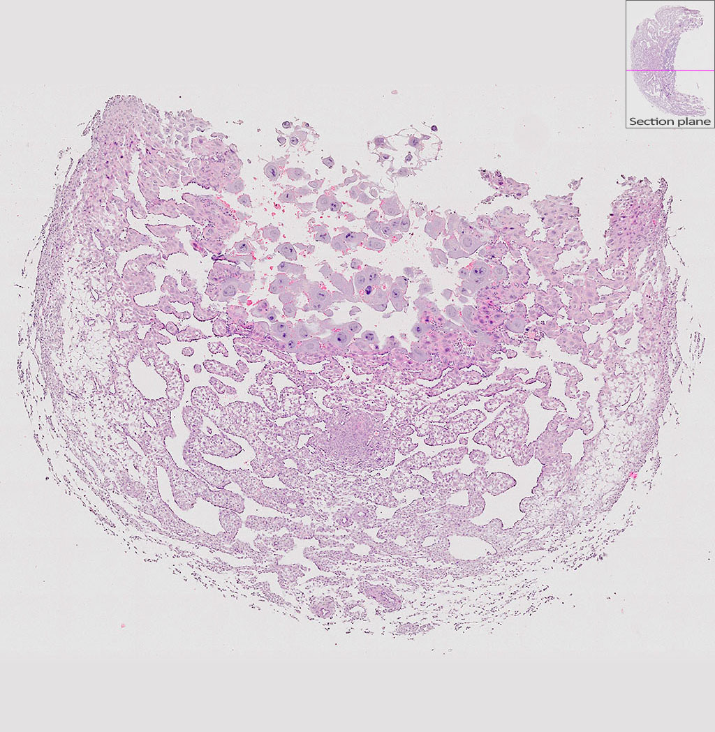 e9.5 mouse placenta