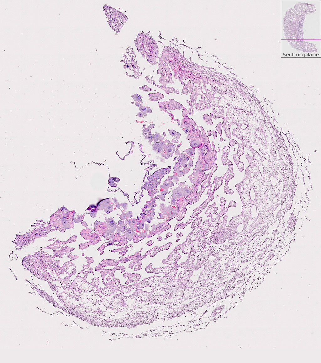 e9.5 mouse placenta
