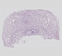 E9.5 mouse placenta