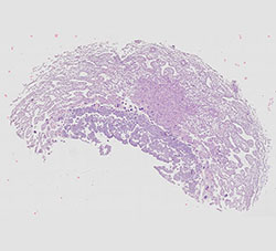 E9.5 mouse placenta