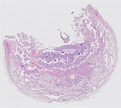 E9.5 mouse placenta