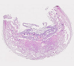 E9.5 mouse placenta