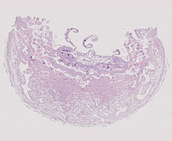 E9.5 mouse placenta