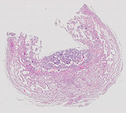 E9.5 mouse placenta
