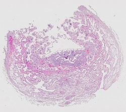 E9.5 mouse placenta