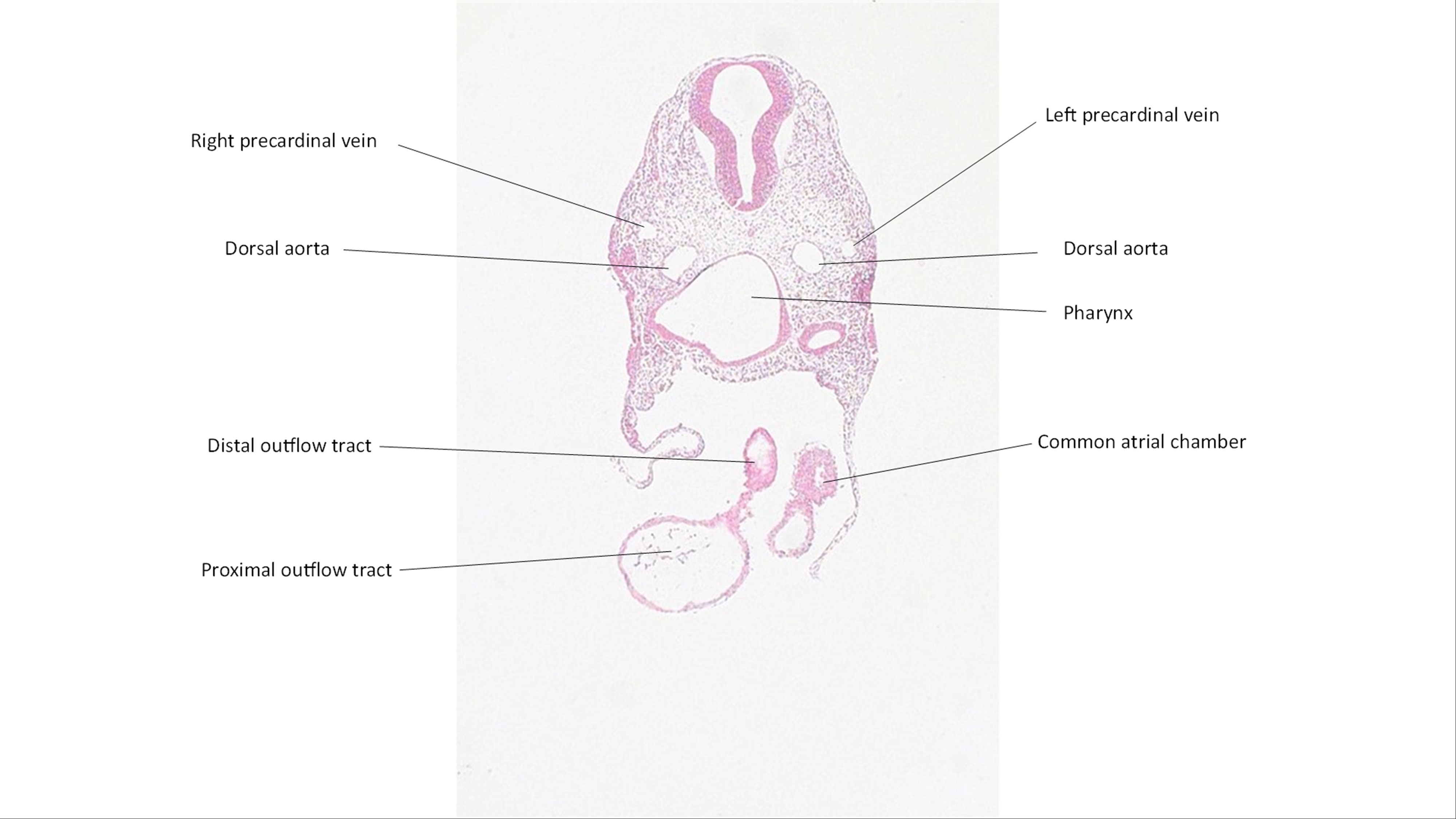A histology section of a human embryo