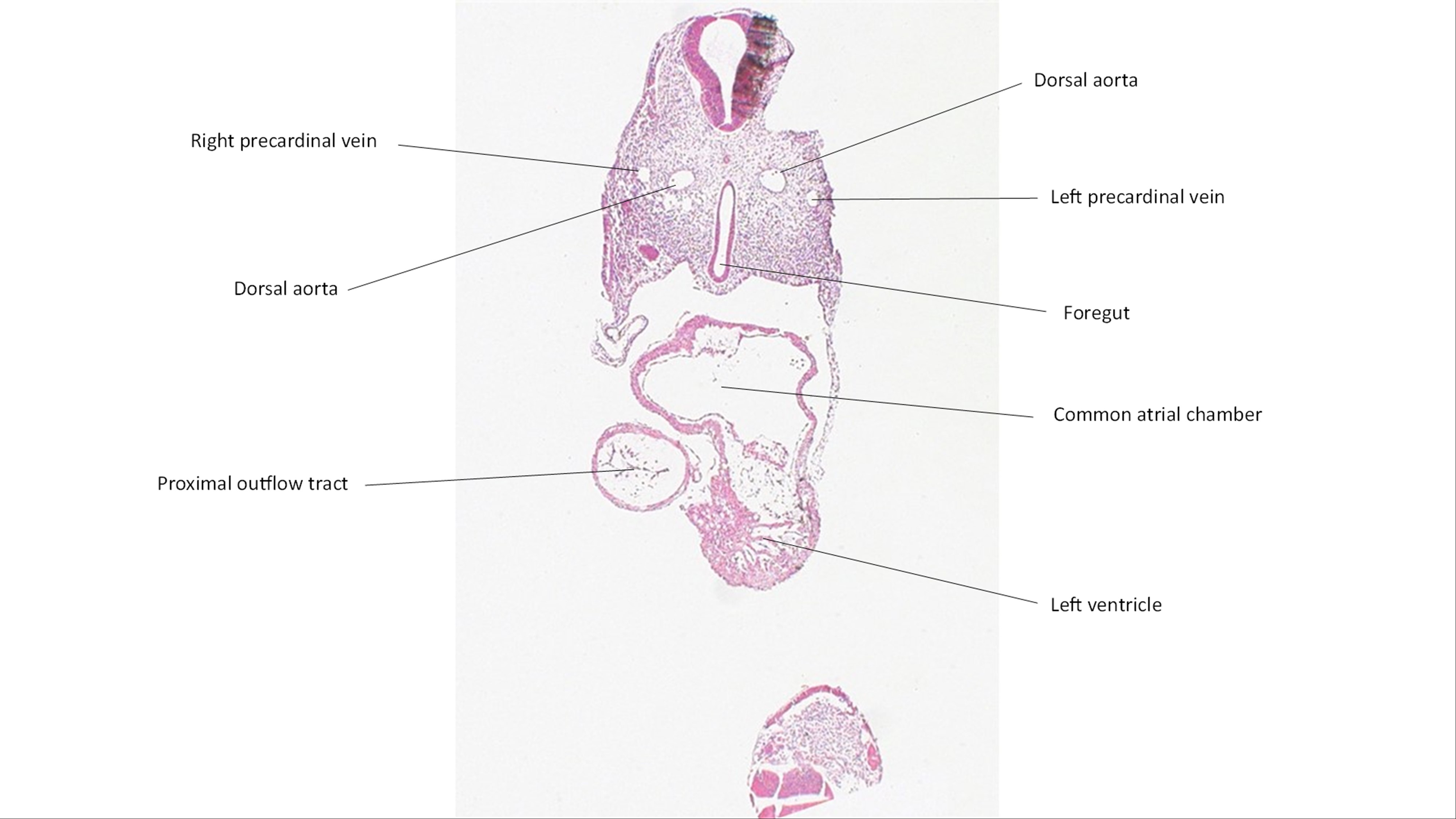 A histology section of a human embryo