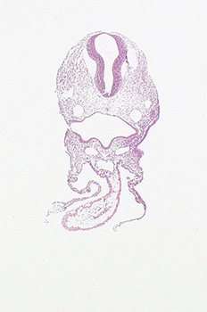 A histology section of a human embryo