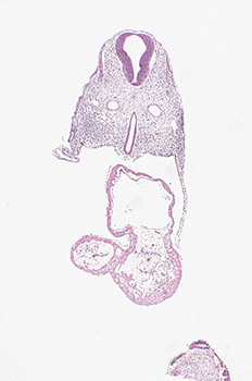 A histology section of a human embryo