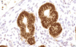 Gene expression in the human fetal pancreas
