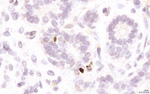 Gene expression in the human fetal pancreas