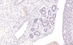 Gene expression in the human fetal pancreas